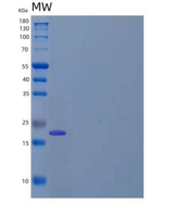 人γ-谷氨酰环转移酶重组蛋白