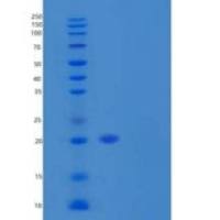 人α-Taxilin/TXLNA重组蛋白N, C-6His