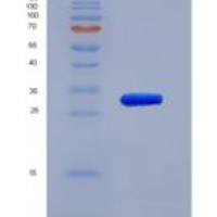 人雌激素受体α(ERa)重组蛋白