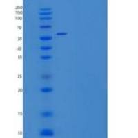 小鼠Carboxylesterase 2E/CES2E重组蛋白C-6His
