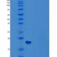人神经胶质纤维酸性蛋白(GFAP)重组蛋白N-6His