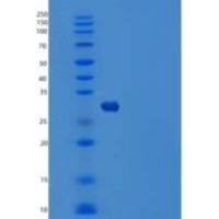 人MOB样蛋白Phocein/MOB4/MOBKL3重组蛋白N-6His