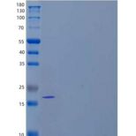 人成纤维细胞生长因子7(FGF7)重组蛋白C-6His