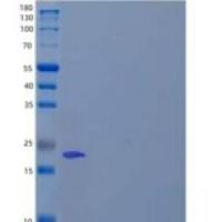 人钙调神经磷酸酶亚单位B1/CNB1重组蛋白N-6His
