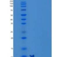 小鼠C-C基序趋化因子3/CCL3/MIP-1a重组蛋白N-6His
