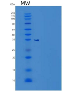 人甘氨酸-N-甲基转移酶(GNMT)重组蛋白N-6His