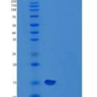 人髓鞘蛋白P0（MPZ）重组蛋白C-6His