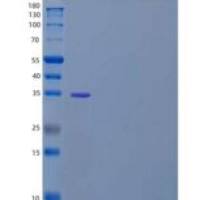 人蛋白磷酸酶1C催化亚单位/PPP1CC重组蛋白N, C-6His
