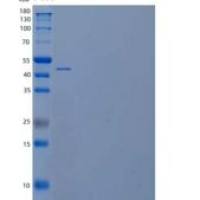 人硒磷酸合酶1/SEPHS1重组蛋白C-6His