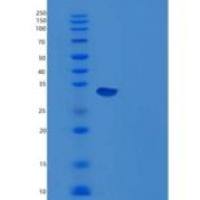 小鼠Carbonic Anhydrase 12/CA12重组蛋白C-6His