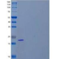 人碱性成纤维细胞生长因子(FGF2)/FGFb 重组蛋白Met134-Ser288