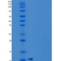 小鼠C-C基序趋化因子24/ccl 24/嗜酸性粒细胞趋化因子-2重组蛋白
