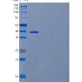 人β-Ureidopropionase/UPB1重组蛋白C-6His