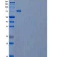 人信号素4B(SEMA4B)重组蛋白C-6His