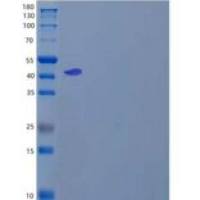 人硒代半胱氨酸裂解酶/SCLY重组蛋白N-6His