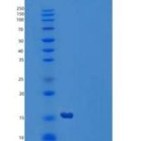 人GABA-A受体关联蛋白样蛋白1(GABARAPL1)重组蛋白N-6His