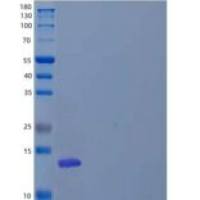 人蝶呤-4-α-甲醇胺脱水酶/PHS/PCBD1重组蛋白N-6His