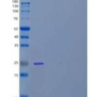 人真核翻译起始因子4E/EIF4E重组蛋白