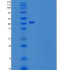 人谷氨酰胺合成酶/谷氨酸重组蛋白C-6His