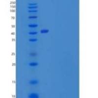 人谷氨酰胺合成酶/谷氨酸重组蛋白C-6His