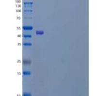 人亮氨酸丰富重复神经元蛋白2(LRRN2)重组蛋白C-6His