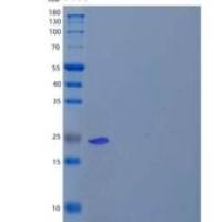 人溶菌酶G样蛋白2/LYG2重组蛋白C-6His