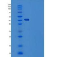 人Serpin F1/PEDF重组蛋白C-6His