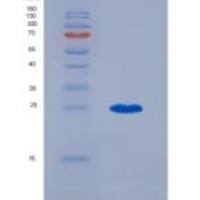 人谷胱甘肽S转移酶π1(GSTp)重组蛋白