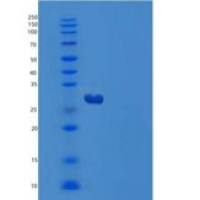 人胱天蛋白酶14(CASP14)重组蛋白C-6His