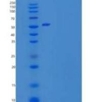 人CD200受体1(CD200R1)重组蛋白C-Fc