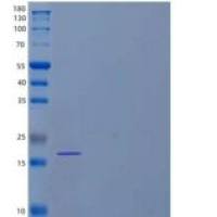 人FAD连接的巯基氧化酶ALR/GFER重组蛋白N-6His
