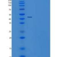 人MAP3K12结合抑制蛋白1/MBIPP重组蛋白N-6His