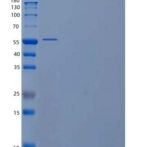 人果糖-2，6-二磷酸酶1/pfkfb 1/PFK/FBP酶1重组蛋白C-6His