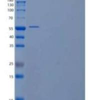 人果糖-2，6-二磷酸酶1/pfkfb 1/PFK/FBP酶1重组蛋白C-6His