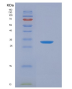 人Carbonic Anhydrase IV (CA4)重组