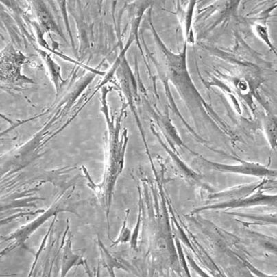 sNF02.2 人1型神经纤维瘤细胞