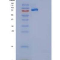 小鼠SELP / selectin P / P-selectin 重组蛋白His tag