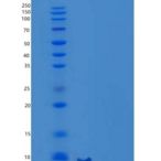 小鼠C-C基序趋化因子8/CCL8/MCP-2重组蛋白C-6His