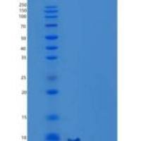 小鼠C-C基序趋化因子8/CCL8/MCP-2重组蛋白C-6His