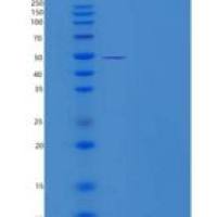 人细胞周期蛋白E1重组蛋白His tag