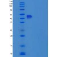 人CST9L / Testatin重组蛋白Fc tag
