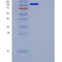 小鼠VEGFR3 / FLT-4重组蛋白Fc tag