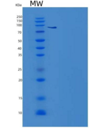 人PBEF / Visfatin / NAMPT重组蛋白Hi