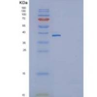 小鼠白介素11受体α(IL11Ra)重组蛋白His tag