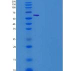 人FGFR3 / CD333重组蛋白alpha(IIIb), Fc Tag