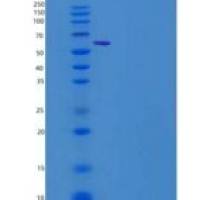 人FGFR3 / CD333重组蛋白alpha(IIIb), Fc Tag