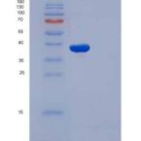 人IL1R1 / CD121a重组蛋白His tag