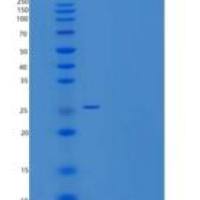 大鼠RAS癌基因家族成员RAB7A(RAB7A)重组蛋白His tag