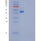 大鼠DDR2 Kinase / CD167b重组蛋白His tag