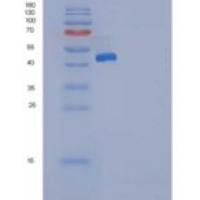 大鼠DDR2 Kinase / CD167b重组蛋白His tag